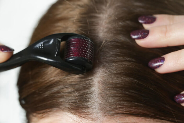 derma roller micro neddles hair